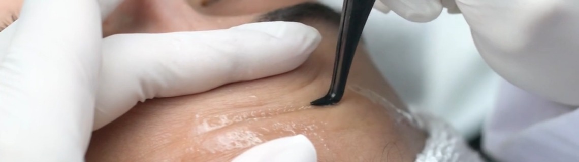 Een afbeelding van bindweefselmassage